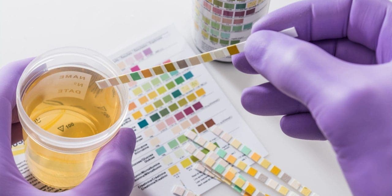 pair of hands wearing purple gloves holding a test kit, left hand with urine sample while the other hand holding the strip