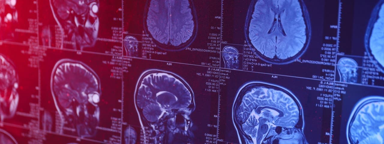 Brain scans next to each other